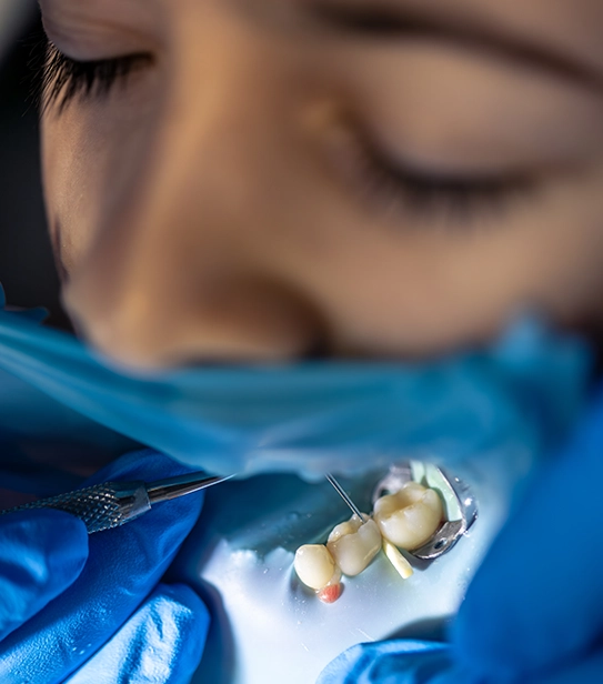 Blurred image of a dental treatment procedure in a clinical setting
