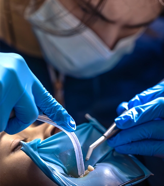 Dental professional placing an inlay or onlay restoration using specialized tools during a dental procedure