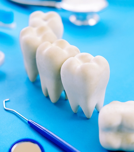 Comprehensive dental care concept showing restorative dentistry options like implants, crowns, and bridges.